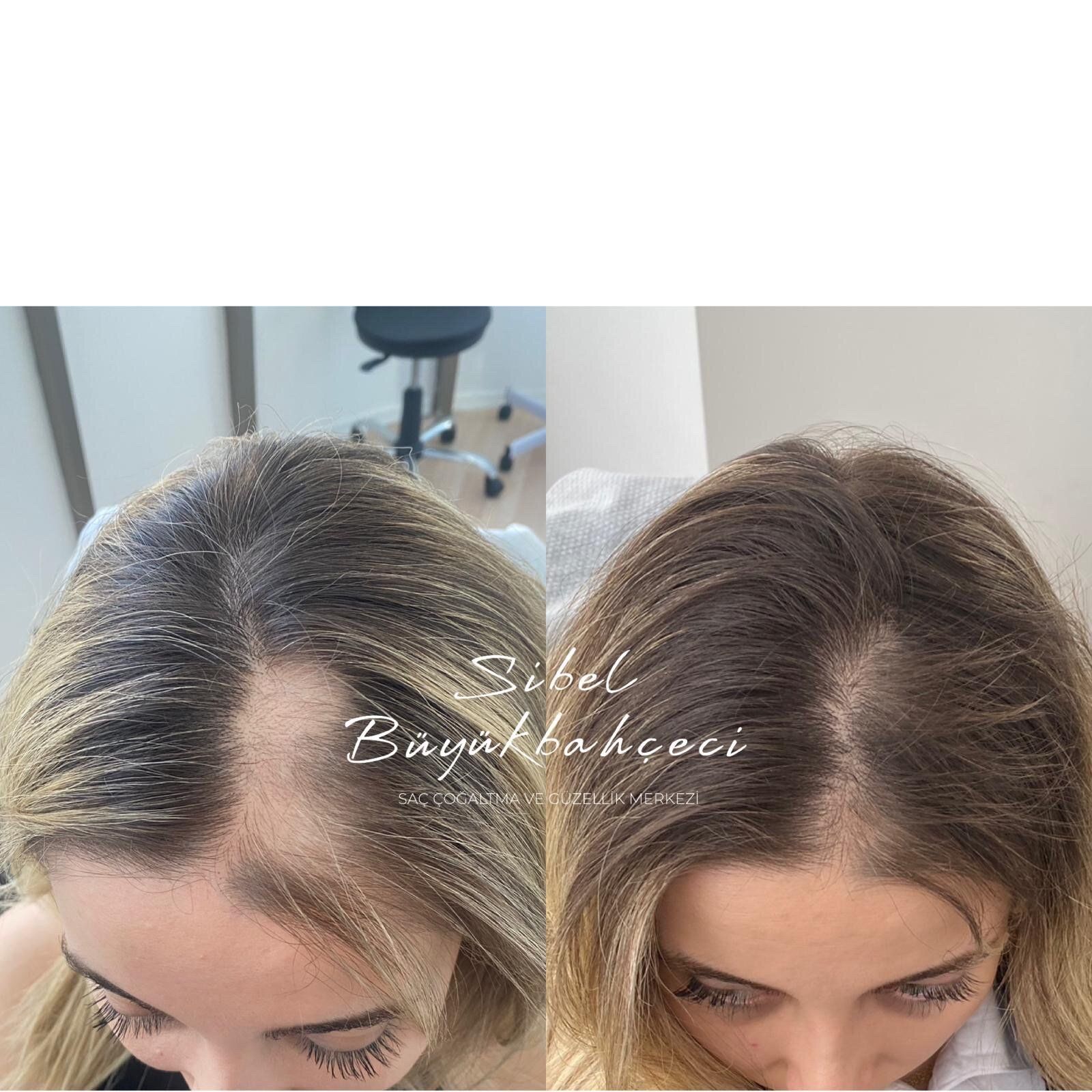 Sibel Büyükbahçeci Hair Multiplication Center